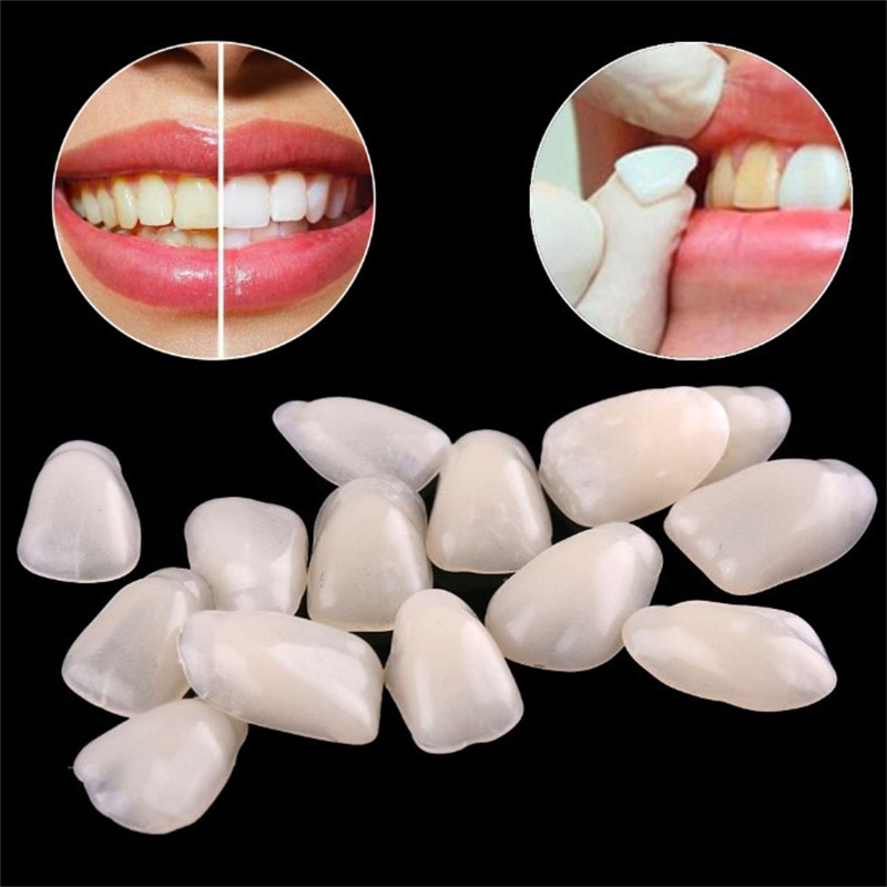Teeth Whitening Veneers - 一時的な歯のベニア - 超薄型レジン歯カバーで歯のホワイトニングと前歯の改善に