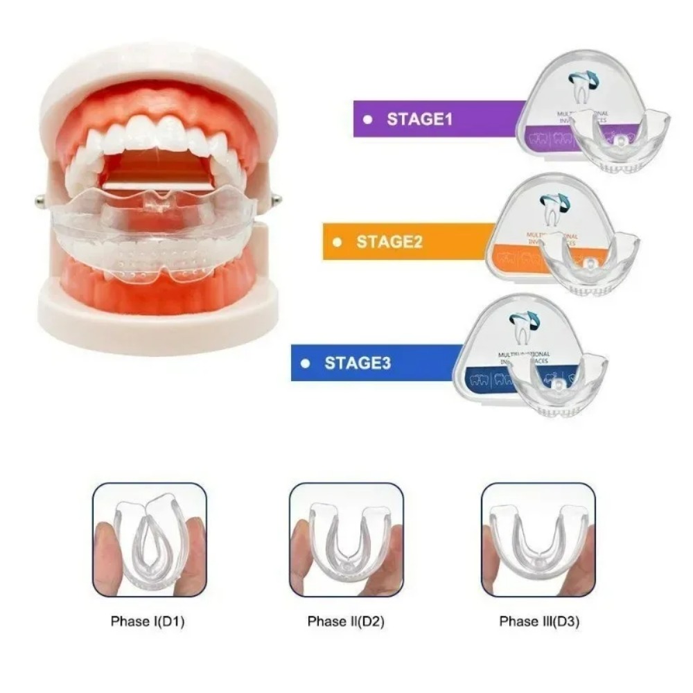 Teeth Whitening For Braces - 歯列矯正ブレースストレートナー歯列矯正器具歯トレーナーアライメントマウスピース大人用歯3段階歯科アクセサリー