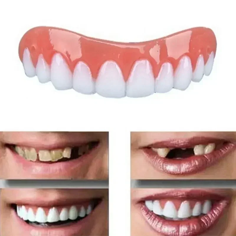 新しいシリコン製義歯 上歯・下歯 ベニア 完璧な笑顔ベニア  - Teeth Whitening Veneers のレビューと価格