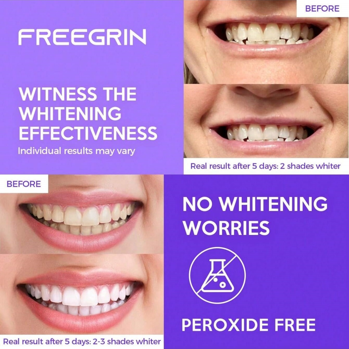 デラックスホワイトニング歯ステッカー 7/14/21 ペアジ - Teeth Whitening Hydrogen Peroxide のレビューと価格