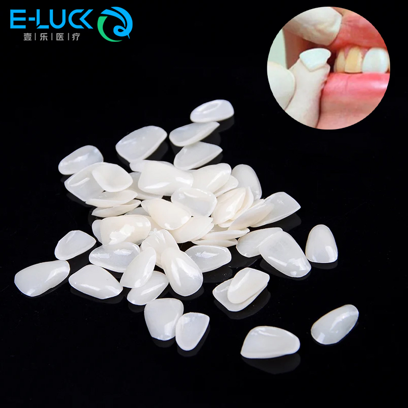 50 個歯科歯ベニア一時的なクラウン超薄型樹脂歯科歯保護口腔 - Teeth Whitening Veneers のレビューと価格