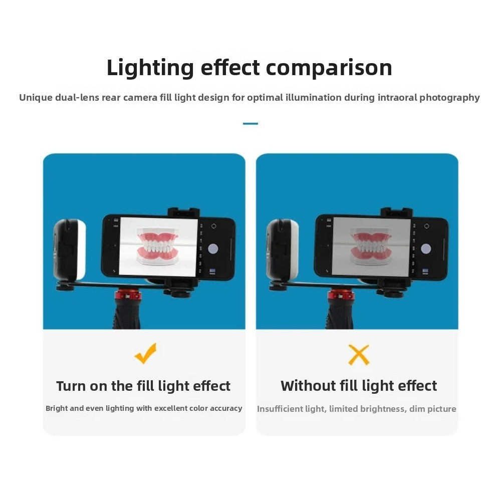 歯科用撮影ライト、スマートフォン用Bluetooth LED - Teeth Whitening Kit With Light のレビューと価格