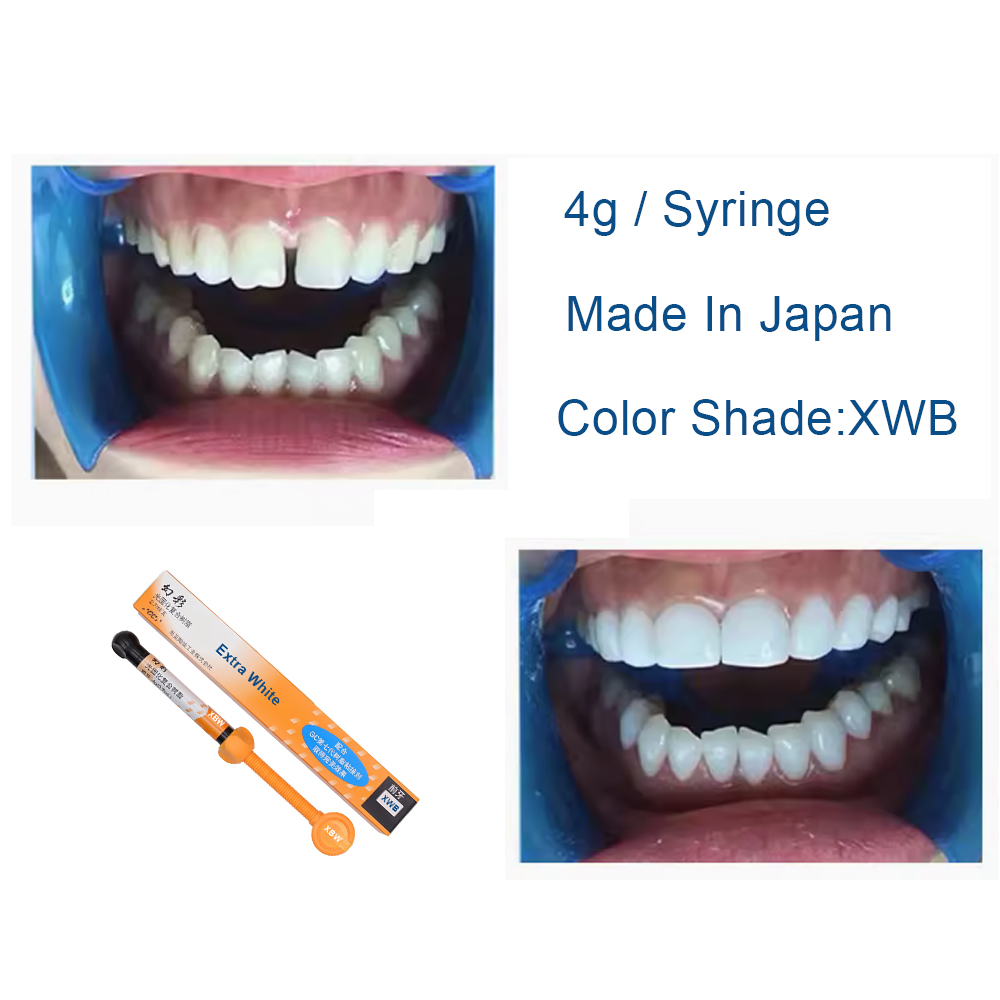 歯科用コンポジットレジン エクストラホワイト XBW BW  - Teeth Whitening Veneers のレビューと価格